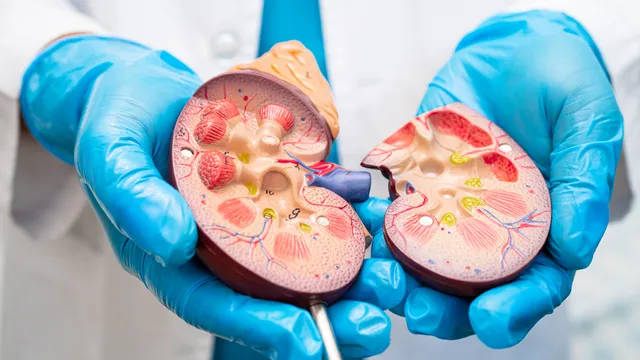 Kidney Stones: కిడ్నీ రాళ్ళ సమస్య తలెత్తే ప్రమాదం.. నిపుణులు ఏమంటున్నారంటే...!!