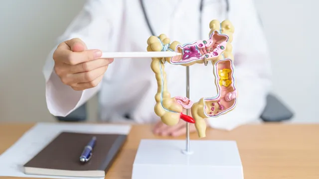 Gastrointestinal cancer: ఈ సంవత్సరాల్లో పుట్టిన వారికి క్యాన్సర్.. భారత్‌లోనే ప్రమాదం ఎక్కువ