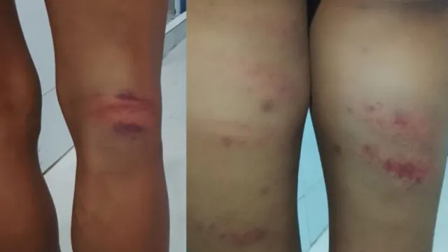 custodial assault: మేఘాలయాలో దారుణం..యువకుడితో టాయిలెట్ నీళ్ళు తాగించిన పోలీసులు