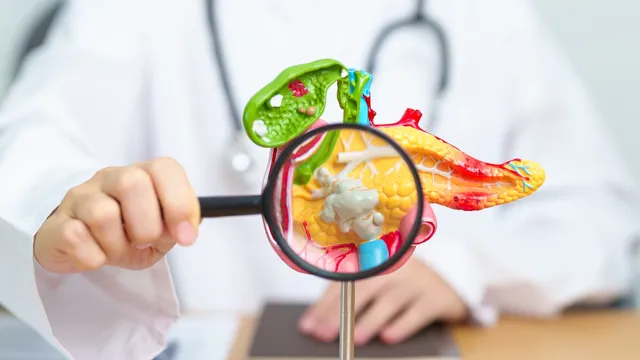 High Cholesterol: ఈ లక్షణాలు మీ చేతులు, కాళ్ళలో కనిపిస్తే.. అది అధిక కొలెస్ట్రాల్‌తోపాటు..!!