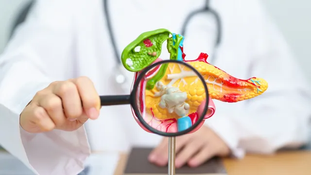 High Cholesterol: ఈ భాగాలలో నొప్పి ఉందా..? ఇది ఆ సమస్యకు సంకేతం కావచ్చు!!