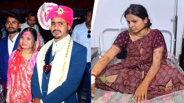 Dowry: కట్నం కోసం వేధింపులు.. నోట్లో వేడివేడి కత్తి పెట్టి.. ఇంకా చెప్పలేని ఘోరాలు!
