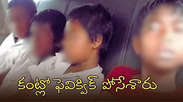 Fevikwik Horror: వీడియో: చిల్లరగాళ్లు.. పడుకున్న 8 మంది విద్యార్థుల కళ్లలో ఫెవిక్విక్ పోసేశారు..