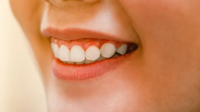 Teeth Tips: చిగుళ్ల నుంచి రక్తస్రావమా..? అయితే గుండెజబ్బు లేక మధుమేహం కావొచ్చు..!!