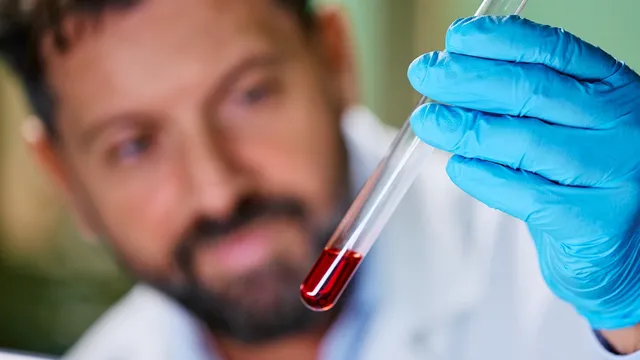 Thick Blood: చిక్కటి రక్తం చక్కబరించేందుకు చక్కటి ఆయుర్వేద ఉపాయం!!