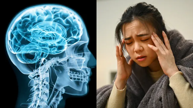 Health Tips: ఈ 5 లక్షణాలు కనిపిస్తే తలనొప్పి కాదు.. బ్రెయిన్ క్యాన్సర్.. జాగ్రత్త!