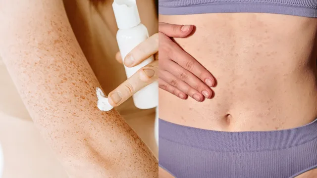 Dark Spots: డార్క్ ప్రైవేట్ పార్ట్స్‌ను శుభ్రం చేయడం ఎలా అని ఆలోచిస్తున్నారా..? వైద్యుల సలహాలు చూడండి!!