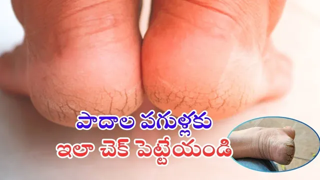 Foot Cracks Tips: శీతాకాల ఎఫెక్ట్.. పాదాల పగుళ్లను జస్ట్ ఈ టిప్స్‌తో కంట్రోల్ చేయొచ్చు..!