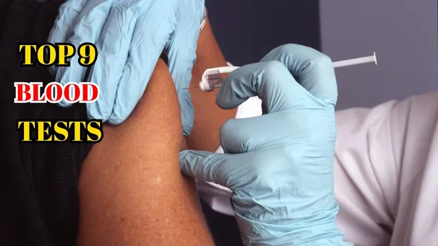 Blood Tests: ఆరోగ్యం కోసం ఒకసారైనా చేయించుకోవాల్సిన 9 రక్తపరీక్షలు ఇవే!