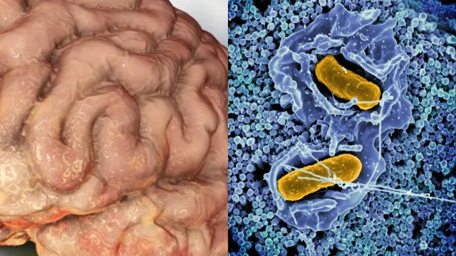 Explainer: కేరళలో కొత్త రోగం.. 42 మంది మృతి.. డేంజర్లో 170 మంది.. ఈ వ్యాధి ఎలా వస్తుందో తెలుసా..?