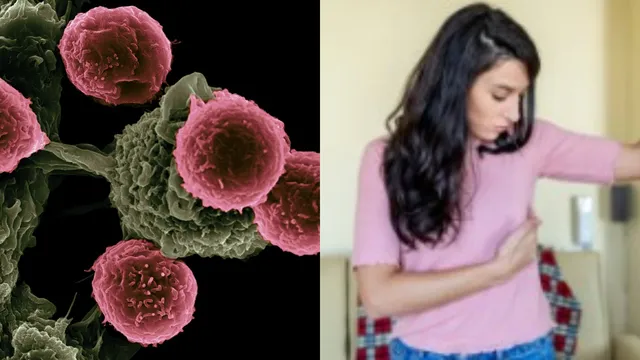 Bra Cancer Risk: బ్రా రంగు, సైజ్ కూడా క్యాన్సర్‌కు కారణమా..?.. వెలుగులోకి షాకింగ్ నిజాలు!