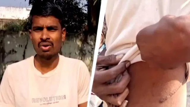 Crime: అసలు లక్ష, వడ్డీ రూ.73 లక్షలు.. కిడ్నీ అమ్మి అప్పు తీర్చిన రైతు