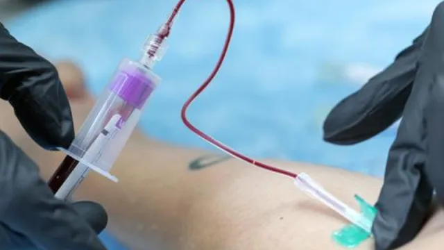 Blood Test: బ్లడ్ టెస్ట్ తో డెత్ డేట్ తెలుసుకోవచ్చా.. షాకింగ్ స్టడీ!