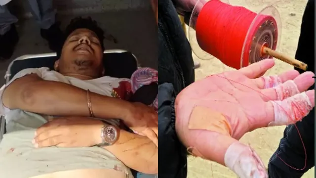 HYD: చైనా మాంజాతో మరో ముగ్గురికి గాయాలు...తీవ్ర గాయాలు కావడంతో...