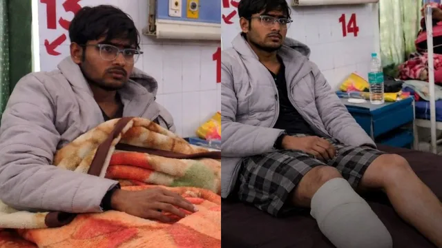 మెడికల్ సీటు కోసం అభ్యర్థి ప్లాన్.. కాళ్లు నరుక్కొని రిజర్వేషన్ కోసం కట్టుకథ