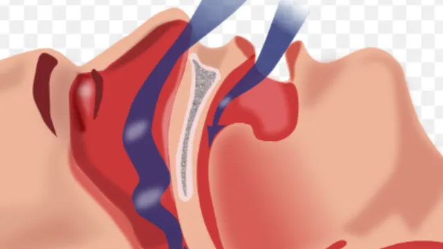 Sleep Apnea : గురక పెట్టేవారు జాగ్రత్త!