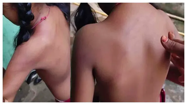 Teacher Beats 3rd class Students: హోమ్ వర్క్ చేయలేదని చిన్నారిని చితకబాదిన హెడ్ మాస్టర్