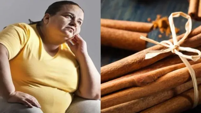 Cinnamon : దాల్చిన చెక్కతో ఊబకాయానికి చెక్‌..వేలాడే కొవ్వు కూడా కరిగిపోతుంది!