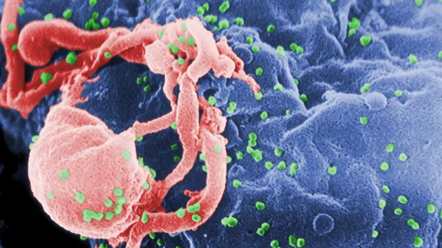 HIV: వైద్యశాస్త్రంలో అద్భుతం.. హెచ్‌ఐవీకి చికిత్స