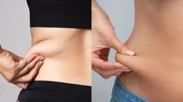Obesity : పెరుగుతున్న బరువు ఏదైనా తీవ్రమైన వ్యాధికి సంకేతమా? మీ జీవనశైలి ఇలా ఉంటే జాగ్రత్తగా ఉండండి!