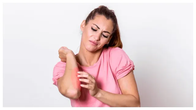 Home Remedies : తేనెని ఇలా రాస్తే కాలిన గాయాలు, మచ్చలు తగ్గిపోతాయట..
