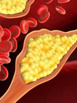 అధిక కొలెస్ట్రాల్‌ను సైలెంట్ క్లియర్ అంటారు