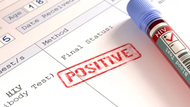 HIV: వాంపైర్‌ ఫేషియల్‌ చేయించుకున్న మహిళలకు హెచ్‌ఐవీ!