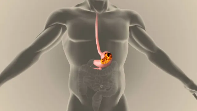 Acidity Reflux : మీరు అసిడిటీతో ఇబ్బంది పడుతుంటే ఇలా చేయండి.. వంటగదిలో ఈ వస్తువులను ఉంచండి!