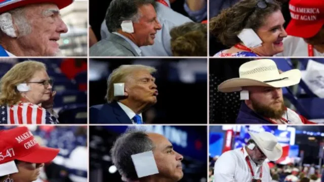 USA: చెవికి బ్యాండేజీలతో సపోర్ట్..కాల్పుల తర్వాత ట్రంప్‌కు భారీగా మద్దతు