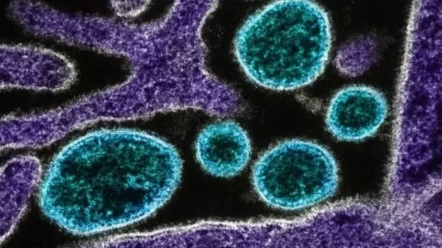 Gujarath: గుజరాత్‌లో చండీపురా వైరస్ కలకలం