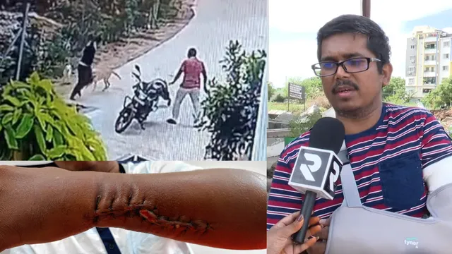 Hyderabad News: షాకింగ్ ఘటన.. రోడ్డుపైకి వచ్చిన పెంపుడు కుక్కలు ఎంత పని చేశాయంటే?