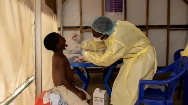 Mpox: విస్తరిస్తోన్న ఎంపాక్స్ వైరస్‌.. డబ్ల్యూహెచ్‌ఓ కీలక ప్రకటన