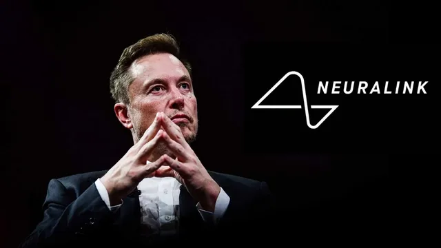Neuralink : ఎలాన్ మస్క్ సంచలనం.. రెండో వ్యక్తికి ఆర్టిఫిషియల్ బ్రెయిన్..  