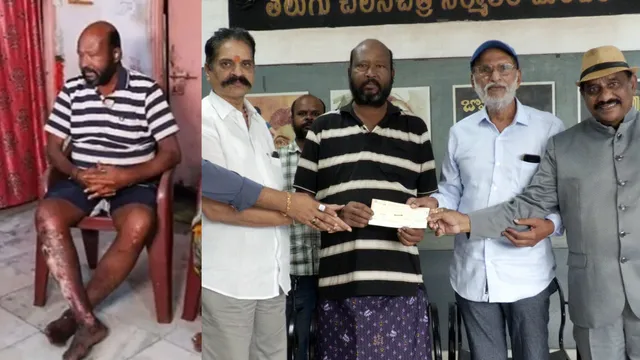 Actor Fish Venkat : నడవలేని స్థితిలో 'గబ్బర్ సింగ్' విలన్.. సాయం కోసం కన్నీళ్లు, ఆదుకున్న నిర్మాతల మండలి