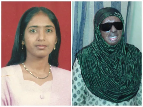 How This Survivor Of An Acid Attack Rebuilt Her Life And Is Now Helping Other Victims To Do The Same