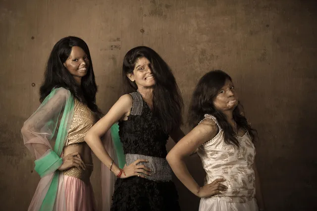 IN PHOTOS: A One-Of-Its-Kind Fashion Shoot With The Most Unique Models You'll Ever See