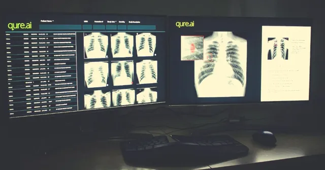 Mumbai Startup's 2-Minute AI Tech Is Revolutionising How India Tackles TB!
