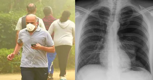 COPD: All you need to know About The Lung Disease That's Killed Millions in India