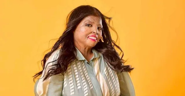 'Art Helped Me Heal': Beauty Content Creator Mannu's Inspiring Journey to Confidence After Surviving a Burn