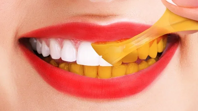 teeth-turn-yellow
