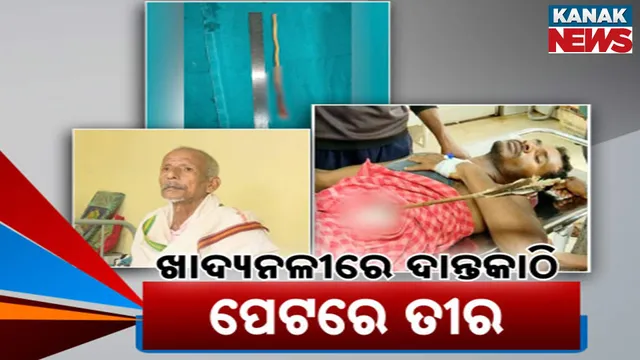 ଏମକେସିଜିରେ ବିରଳ ଅସ୍ତ୍ରୋପଚାର