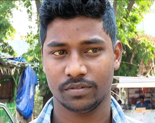 କାୟା ମେଲାଉଛି ଜଣ୍ଡିିସ୍