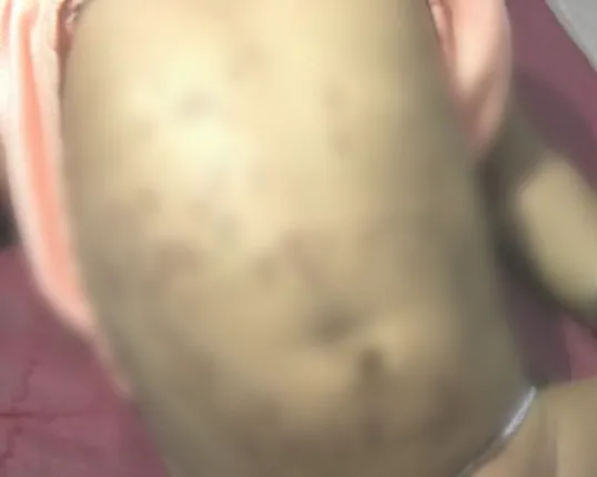 ପୁଣି ସାମ୍ନାକୁ ଆସିଛି ନବରଙ୍ଗପୁର ଶିଶୁ ଚେଙ୍କ ଘଟଣା