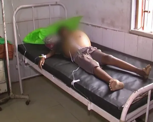 ଗରିବ ମୁଣ୍ଡରେ ଚଡକ :୧୧ବର୍ଷର ପୁଅ ପେଟରେ ବଢୁଛି ଟ୍ୟୁମର