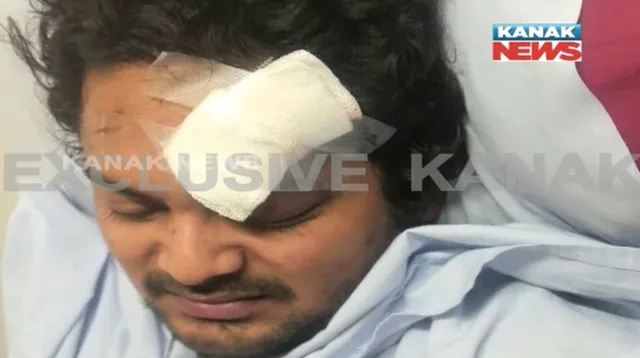 କଟକ ମର୍କତନଗର ନିକଟରେ ଅମ୍ଳାନଙ୍କ ଗାଡି ଦୁର୍ଘଟଣା ଗ୍ରସ୍ତ : ଘରୋଇ ହସ୍ପିଟାଲରେ ଭର୍ତି ହୋଇଛନ୍ତି ଅମ୍ଳାନ