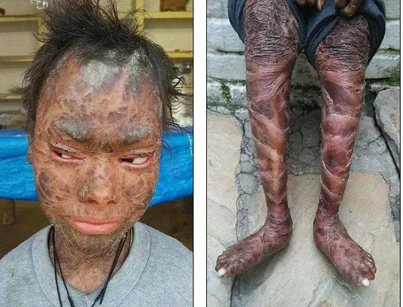 ପ୍ରତି ଘଣ୍ଟାରେ ସ୍ନାନ କରନ୍ତି ଏ ଝିଅ ! ନୁହେଁତ ସାପ ଭଳି ହୋଇଯାଉଛି ଚେହେରା