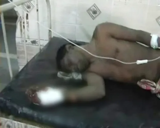 ନିଜ ଜାଲରେ ନିଜେ ଫସିଲେ! ଅନ୍ୟ ଜଣକୁ ହତ୍ୟା କରିବାକୁ ଯାଉଥିବା ବେଳେ ମୋବାଇଲ୍ ଫାଟି ଯୁବକ ଗୁରୁତର