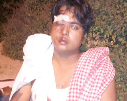 ଗୁଜବ ପରେ ବାବୁସାନ ବଦନାମ୍ ! ଚକଲେଟ୍ ବୟ ମାଡ ଖାଇଥିବା ନେଇ ସୋସିଆଲ୍ ମିଡିଆରେ ଫଟୋ ଭାଇରାଲ୍