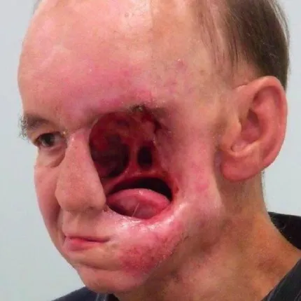 ଅବହେଳା ପଡିଲା ମହଙ୍ଗା ! ଛୋଟ ଘା’ ବିଗାଡି ଦେଲା ବ୍ୟକ୍ତିଙ୍କର ସଂପୂର୍ଣ୍ଣ ଚେହେରା