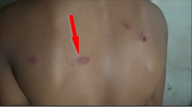 ନିଷ୍ଠୁର ସାଜିଲେ ଶିକ୍ଷକ : ମାଡ ମାରି କ୍ଷତବିକ୍ଷତ କଲେ ଛାତ୍ରଙ୍କୁ